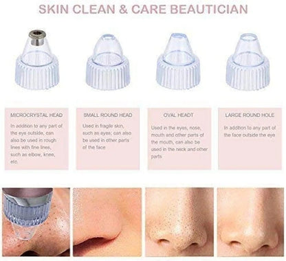 Derma Suction Cell Operated – Facial Skincare Suction Device