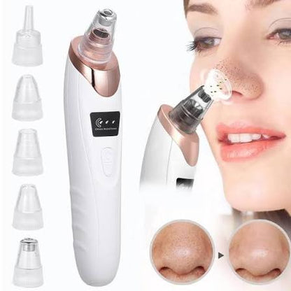 Premium 5-in-1 Blackhead Remover